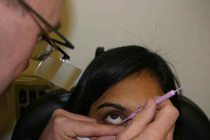 puntal plug fitting dilation - Matheson Optometrists